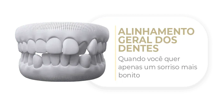 Caso tratável com Invisalign