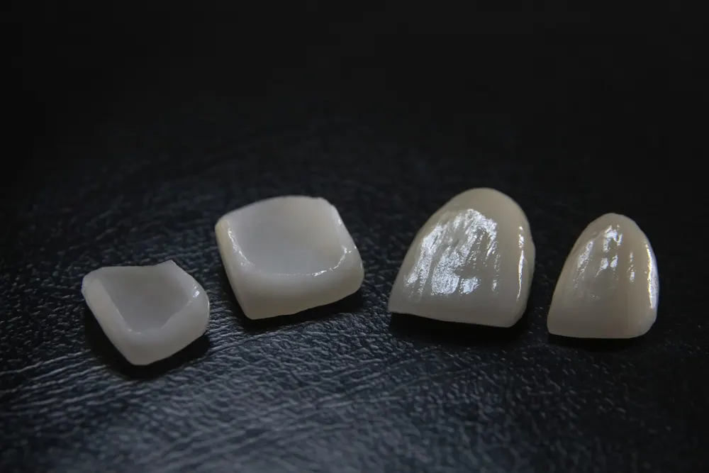 Lentes de contato dental em porcelana