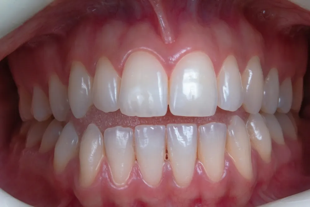 Sorriso saudável (foto ilustrativa)